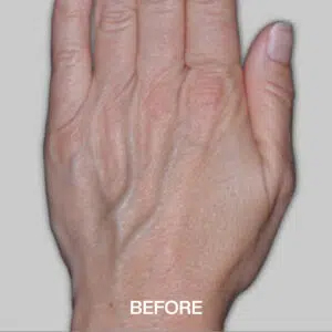 Ageing hands