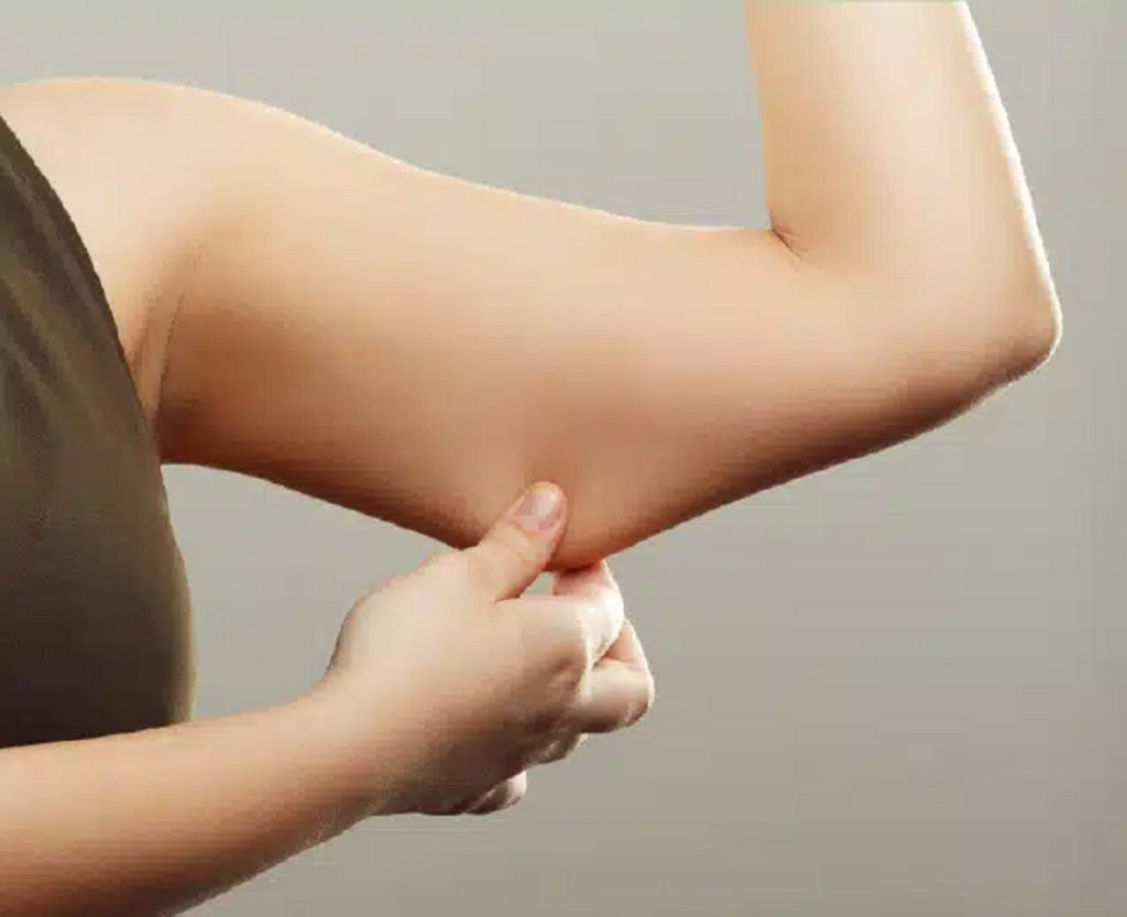 SKIN SAGGING TREATMENT LIVERPOOL