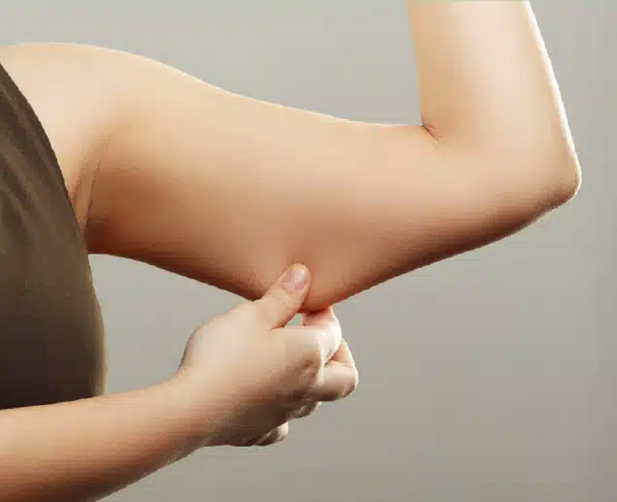 SKIN SAGGING TREATMENT LIVERPOOL