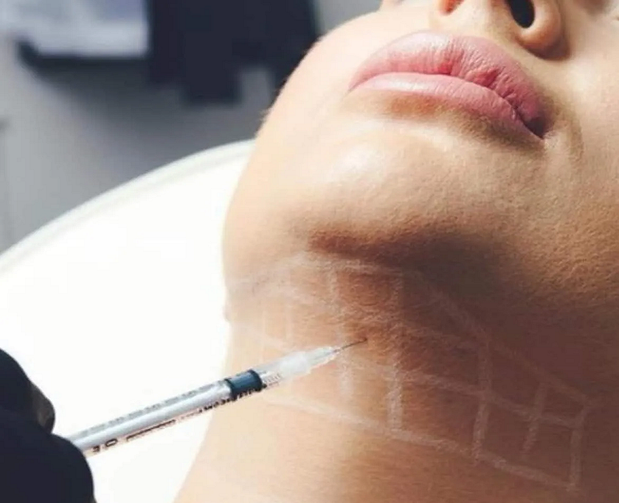 Fat Dissolving Injections