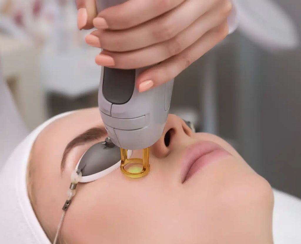 IPL PHOTOFACIAL
