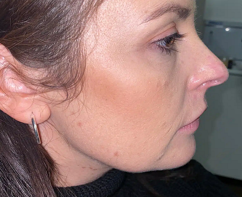 8 Best Jawline Hairstyles For Sagging Jowls