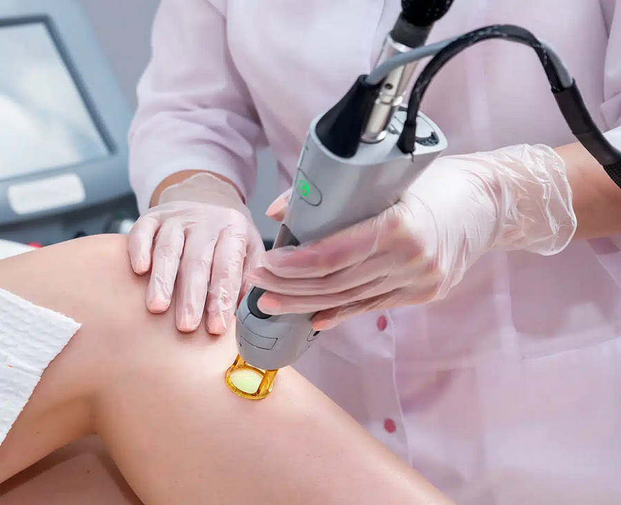 LASER HAIR REMOVAL NEAR ME