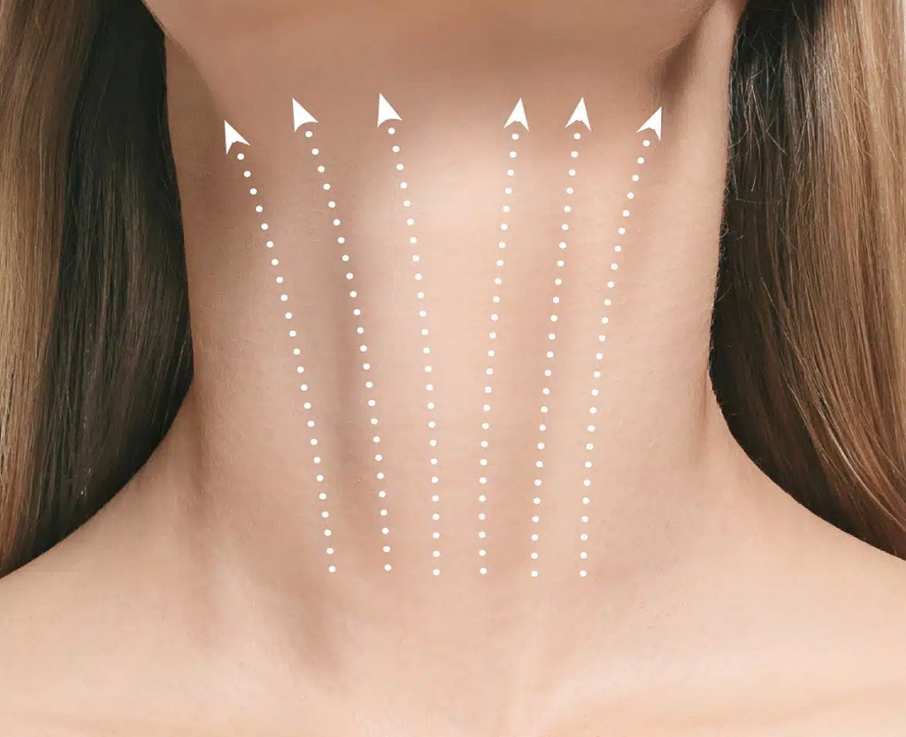 BOTOX NECK LIFT