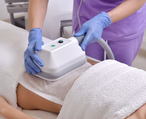 NON SURGICAL FAT REMOVAL