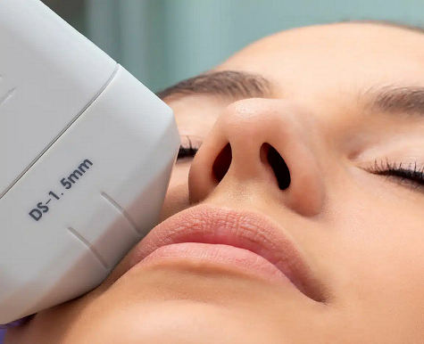 INTENSE PULSED LIGHT THERAPY