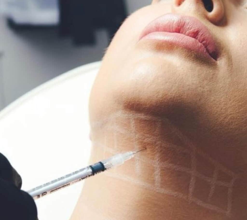 fat-dissolving-injections-liverpool-aqualyx-fat-dissolving