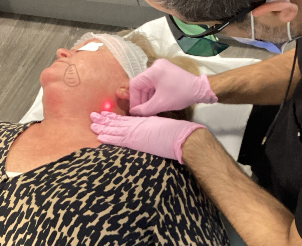 Mandibular Jaw Endolift