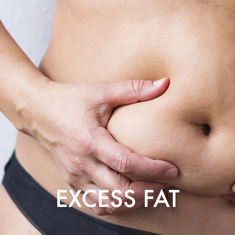 Excess Fat