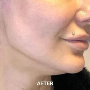 jaw definition after