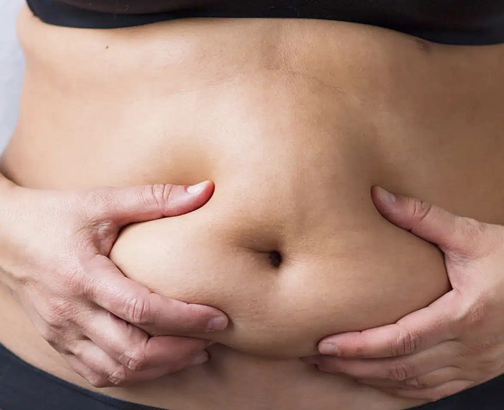 Reduce Unwanted Stomach Fat