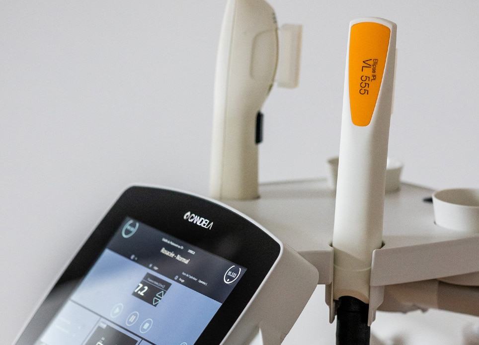 rosacea treatment reviews