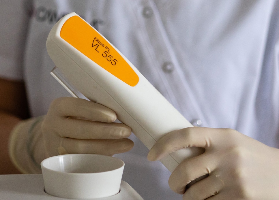 rosacea treatment over the counter