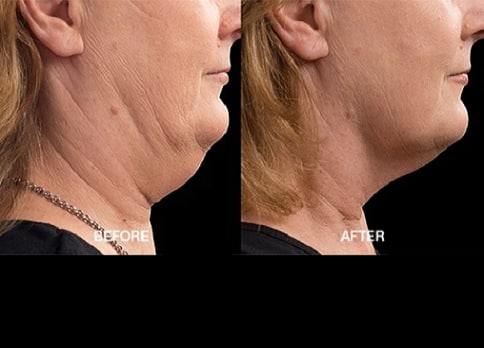 more defined jawline