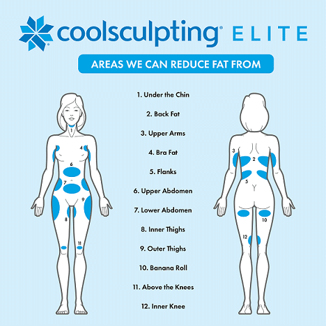 coolsculpting elite illustration showing what is coolsculpting and what areas it can treat
