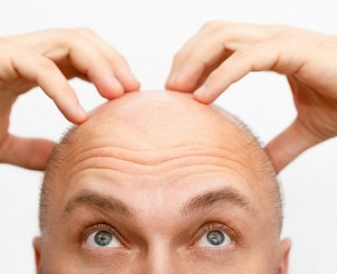 hair transplant clinic liverpool