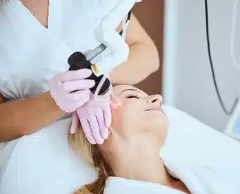 fractional co2 liverpool