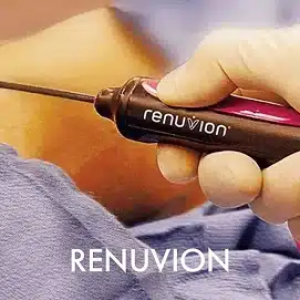 renuvion